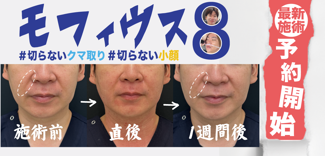 "モ</p