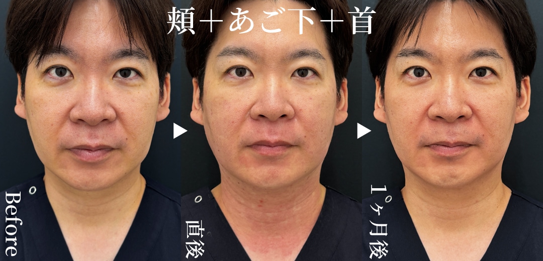 小野﨑医師がフェイスラインに！