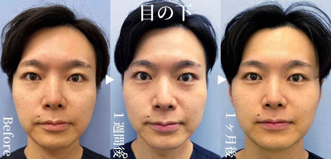 澁川医師が目の下に！