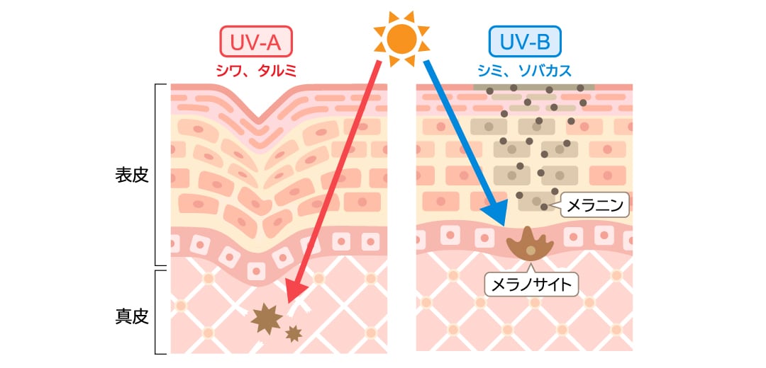 なぜ日焼けは起こるのか
