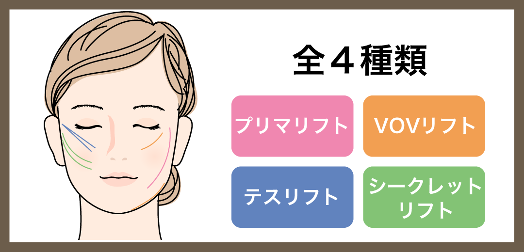 糸リフトの種類は?