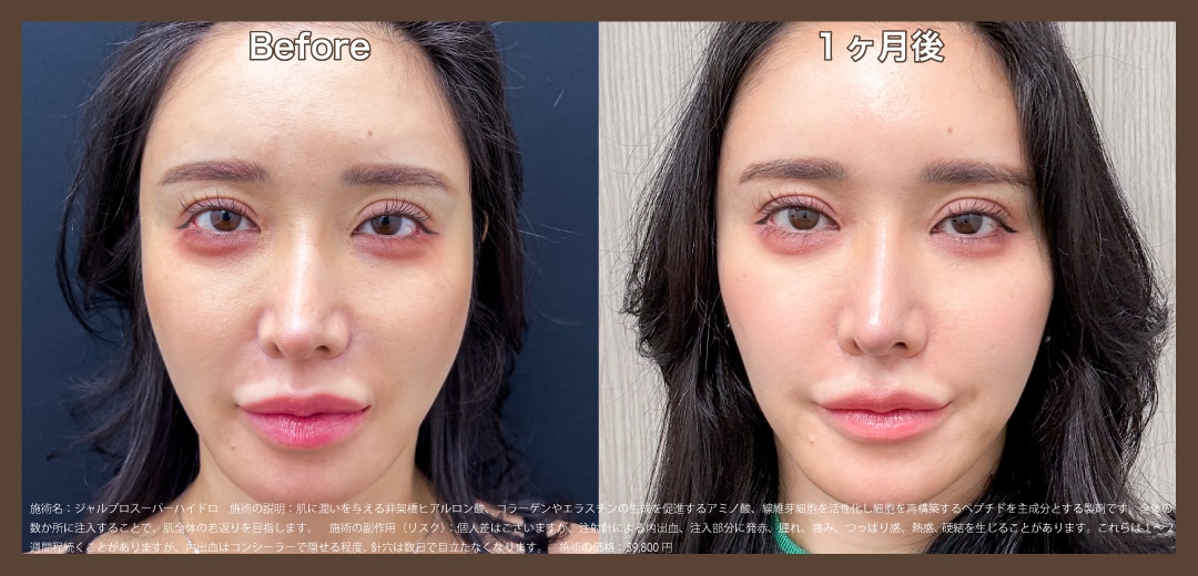 施術前後で感じる自然な変化