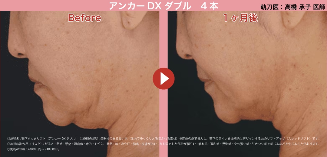 横顔のラインを整えたい方