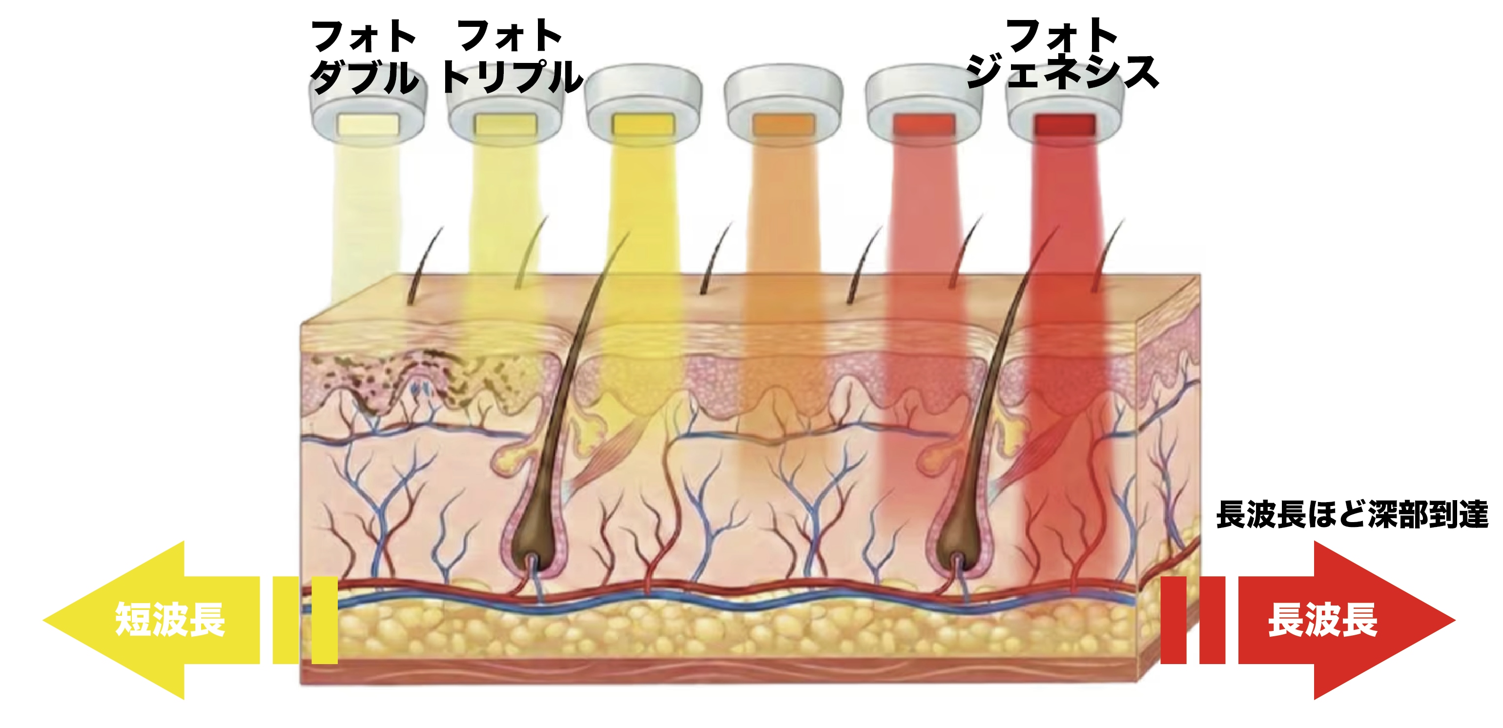 年齢肌に寄り添う光治療