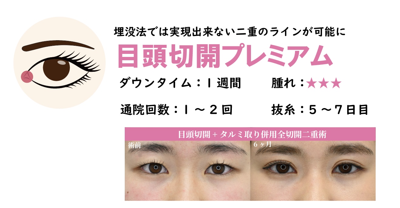 目頭切開プレミアム