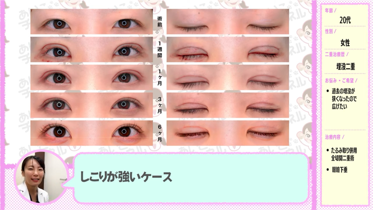 ポツッとできた不自然な「しこり」
