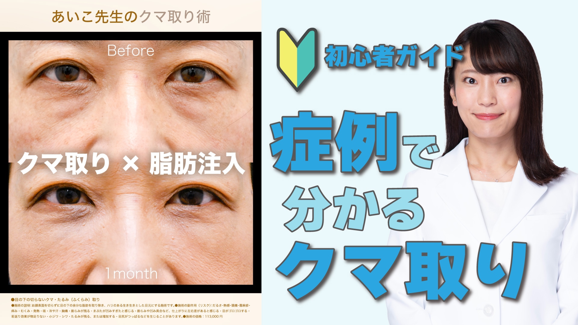 町田でクマ取りを検討中の方へ
