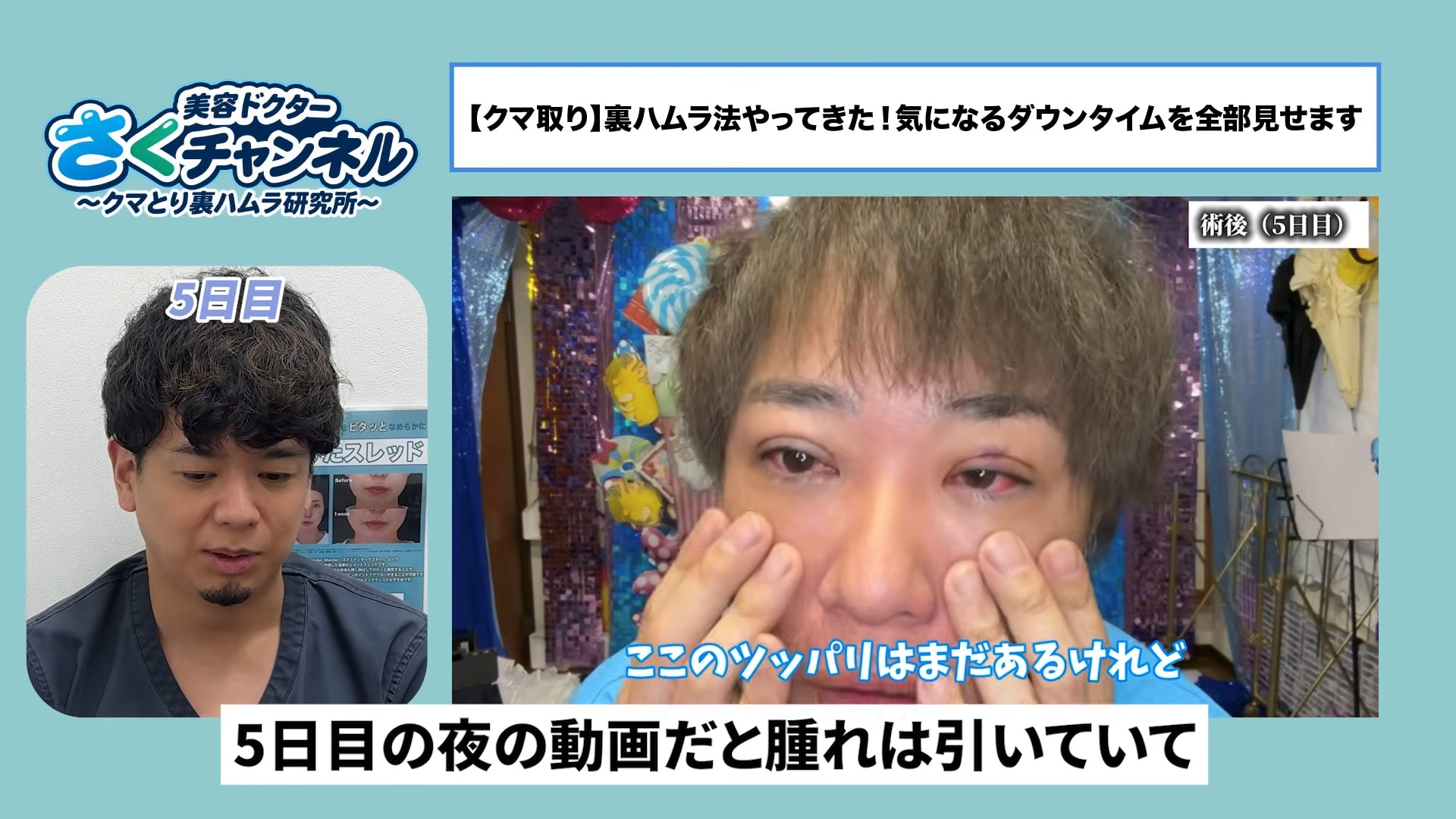 術後5日目<br />
