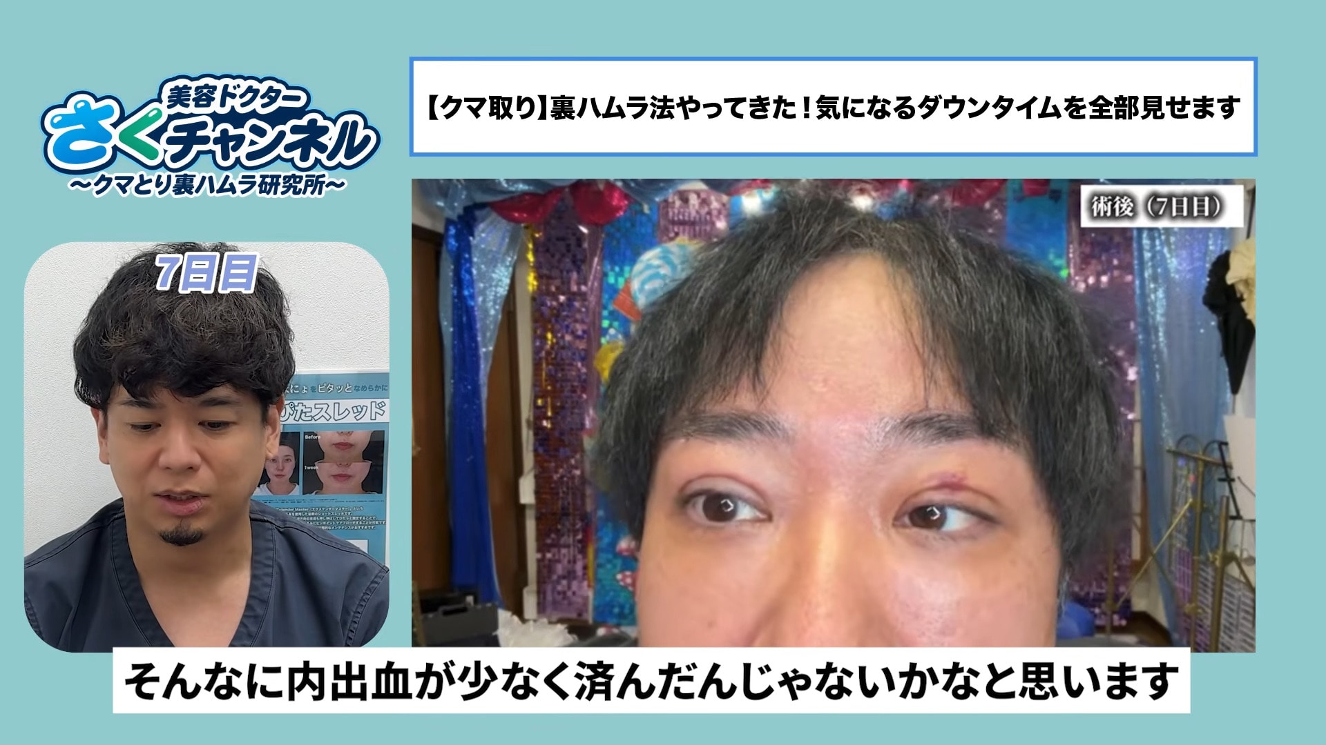 術後1週間