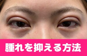 寝て起きた時が一番腫れる!