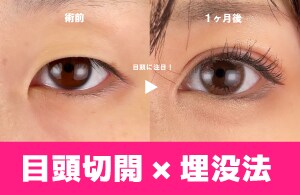 【垢抜けたい方】モデルのような美しい目元になりたければ絶対におすすめ!