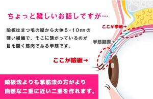 挙筋法と瞼板法について②