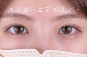 挙筋法・瞼板法のメリットとデメリット