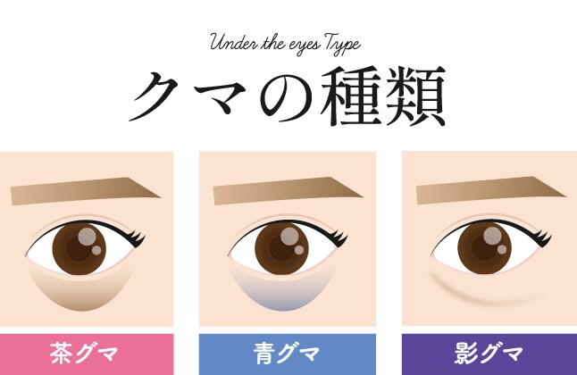 目の下のクマにはパターンがある!?