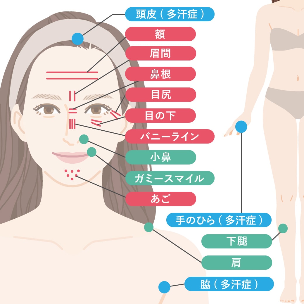 下着泥棒　顔出し いまさら聞けない】ボトックスの効果や注意点とは？松戸院で人気な部位もご紹介 - 松戸院