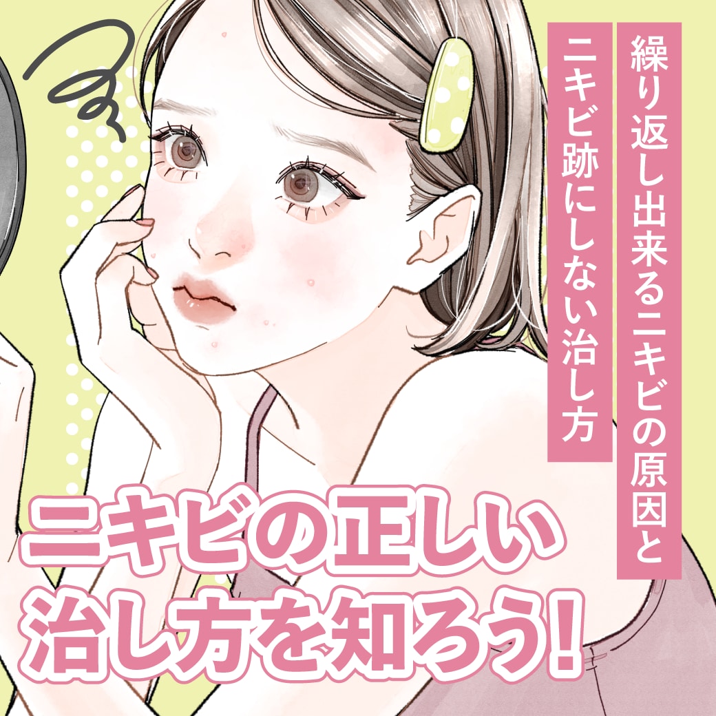 繰り返しできるニキビの原因とニキビ跡しない治し方とは