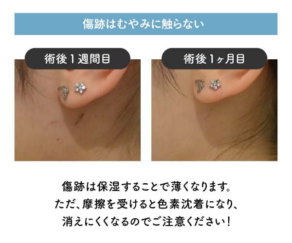 傷跡はむやみに触らない