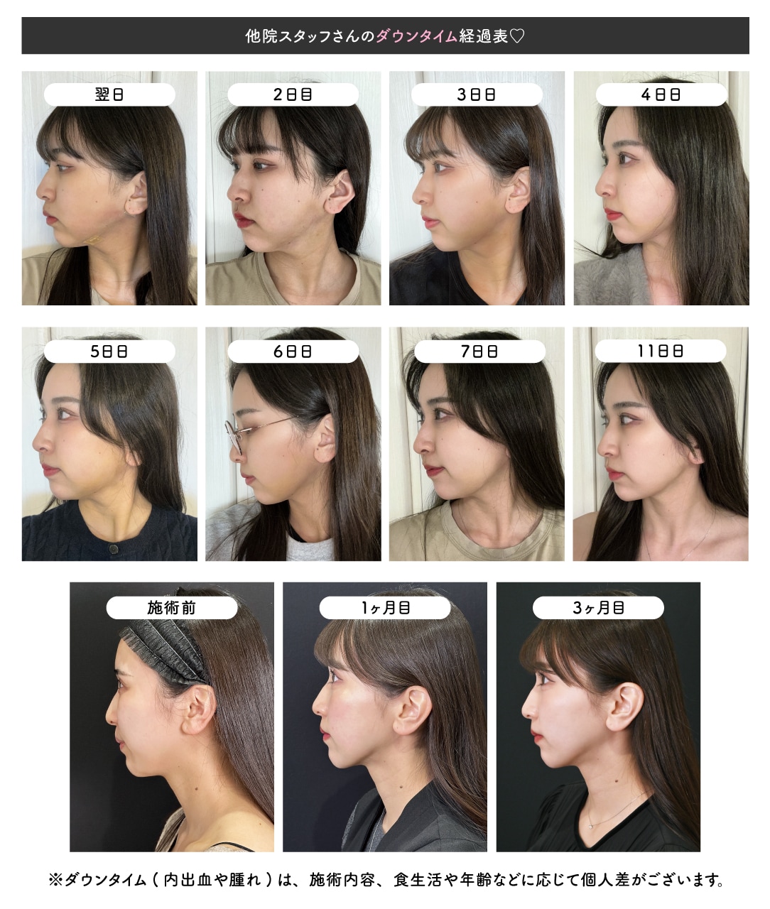 当時のメディア報道・掲載写真