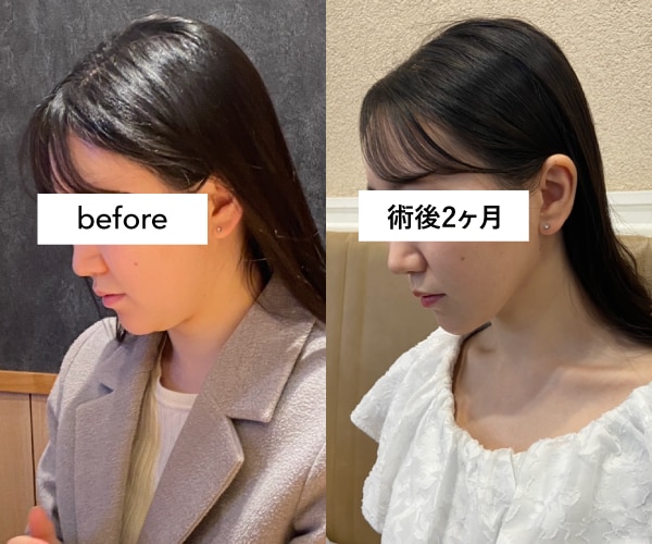 スタッフみんなが「羨ましい！」と言う仕上がりに