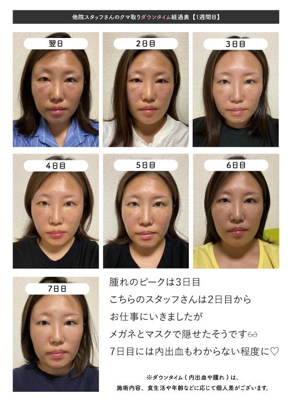 ダウンタイム2週間分を公開!