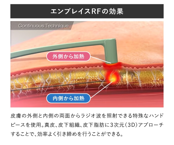 皮膚の「内側と外側」から引き締める最先端テクノロジー