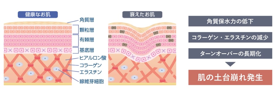 肌育注射とは（若い肌と年齢を重ねた肌の違い）