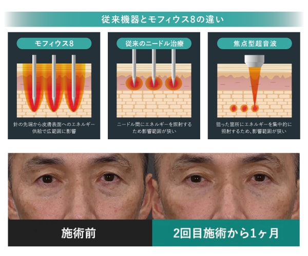 モフィウス8の役割