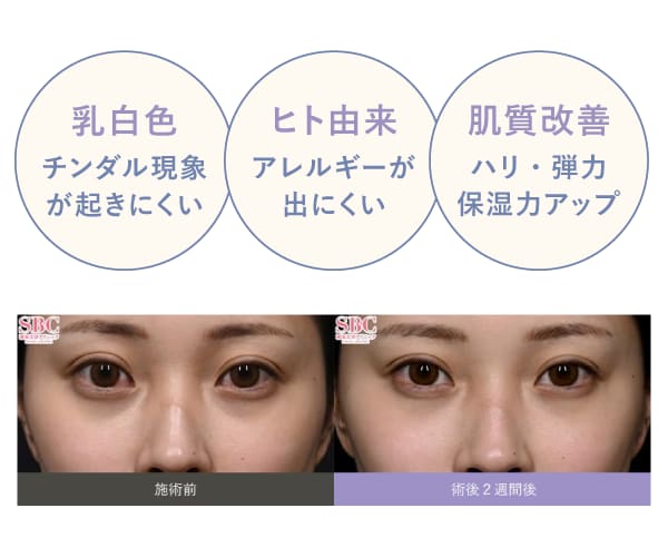 ベビーコラーゲンの役割