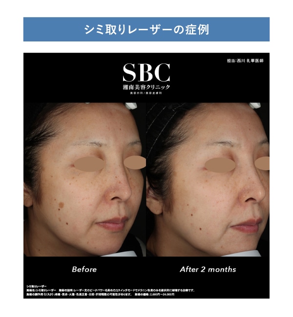 美容初心者の方もご安心ください