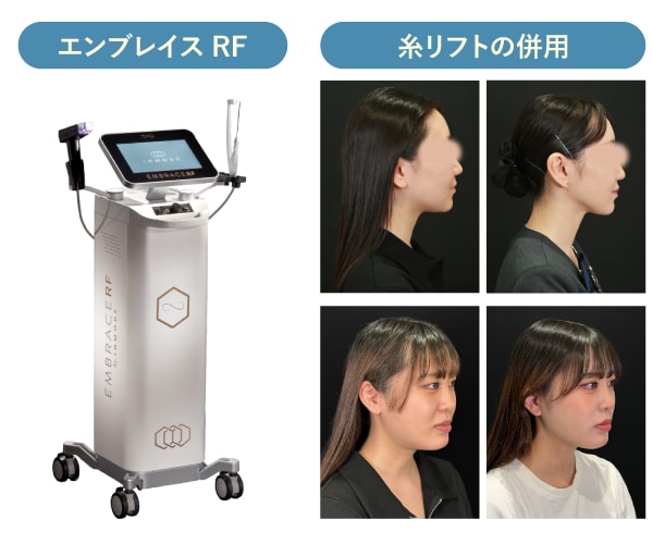 おすすめのコンビネーション治療