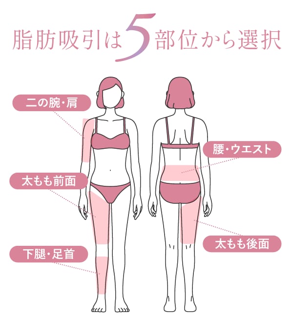 脂肪吸引箇所
