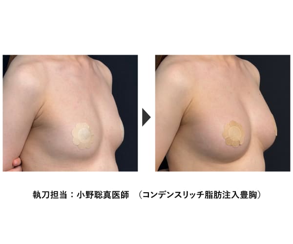 脂肪注入豊胸するなら、松戸院 院長の小野聡真医師にお任せ