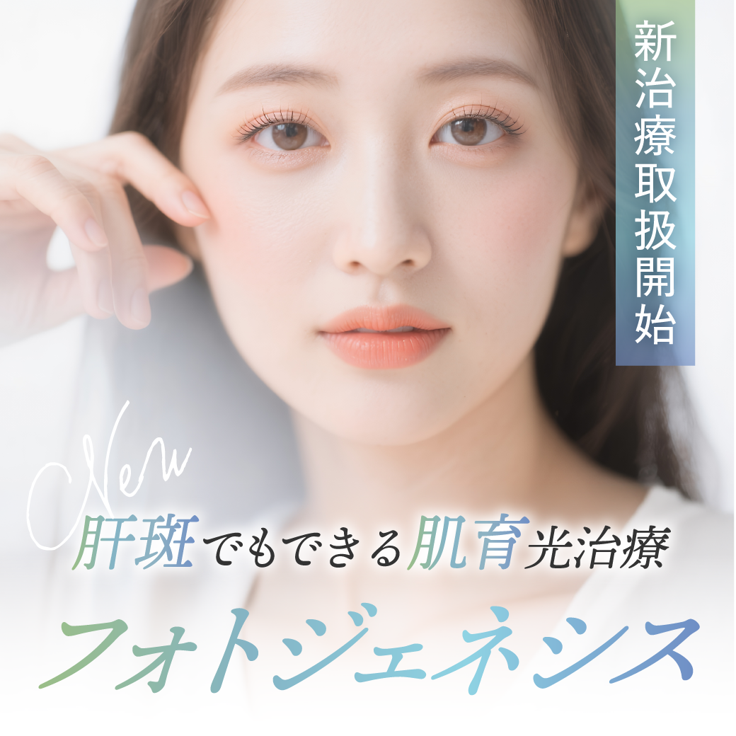 【肌育治療ならSBC松戸院で】肝斑がある人もできるIPL?! 肌育治療「フォトジェネシス」登場！