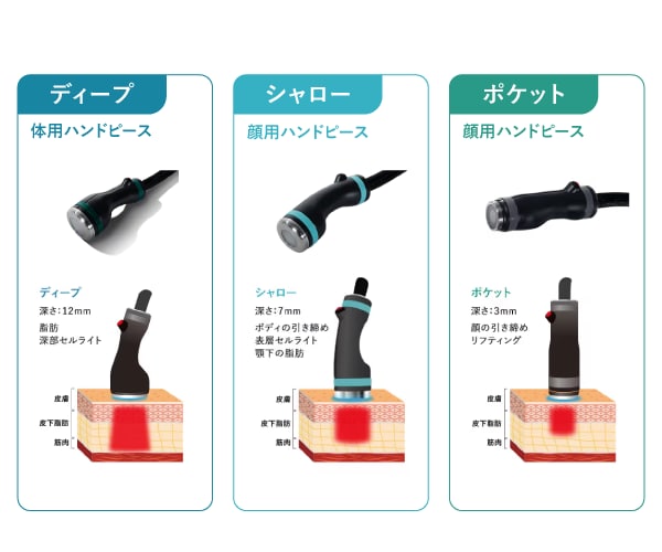 オンダリフトのメカニズムとは