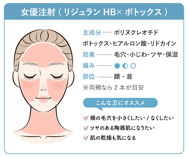 【毛穴・ツヤ・保湿】女優注射（リジュランHB＋ボトックス）
