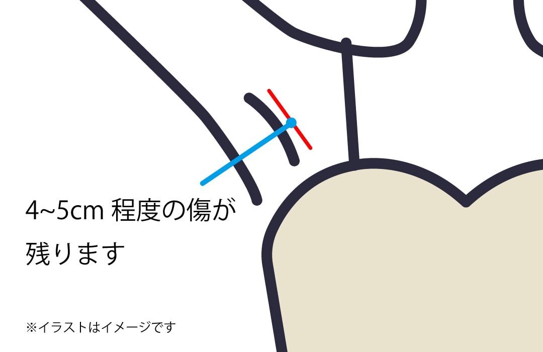 もう1つの大きな壁