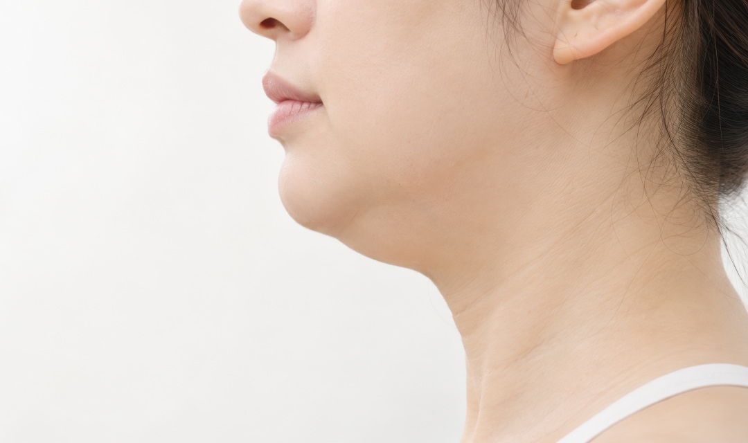 ② 輪郭の四角さ（ベース顔化）と二重アゴの解消