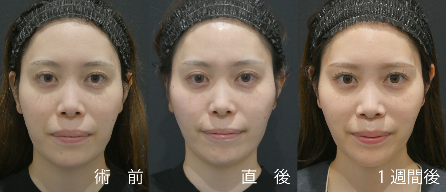 ① 骨格と表情の動きを見極める「オーダーメイドベクターデザイン」
