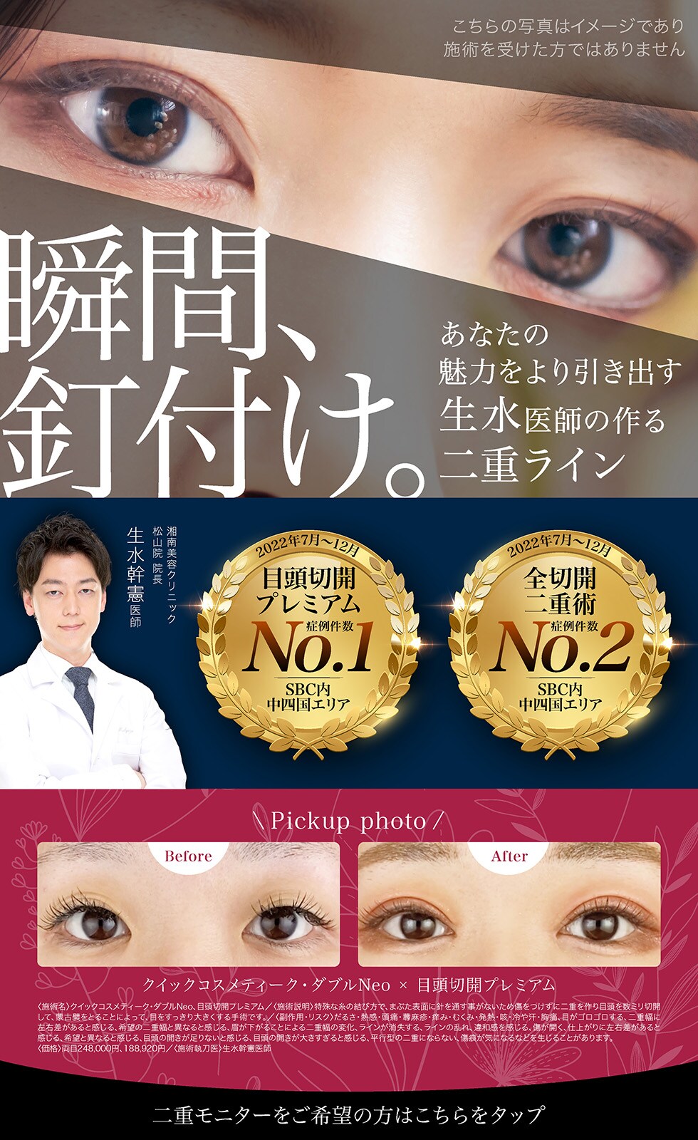 瞬間、釘付け。あなたの魅力をより引き出す生水医師の作る二重ライン