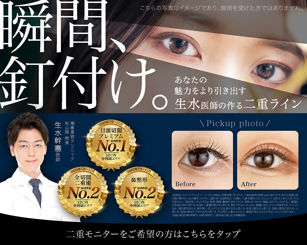 瞬間、釘付け。あなたの魅力をより引き出す生水医師の作る二重ライン