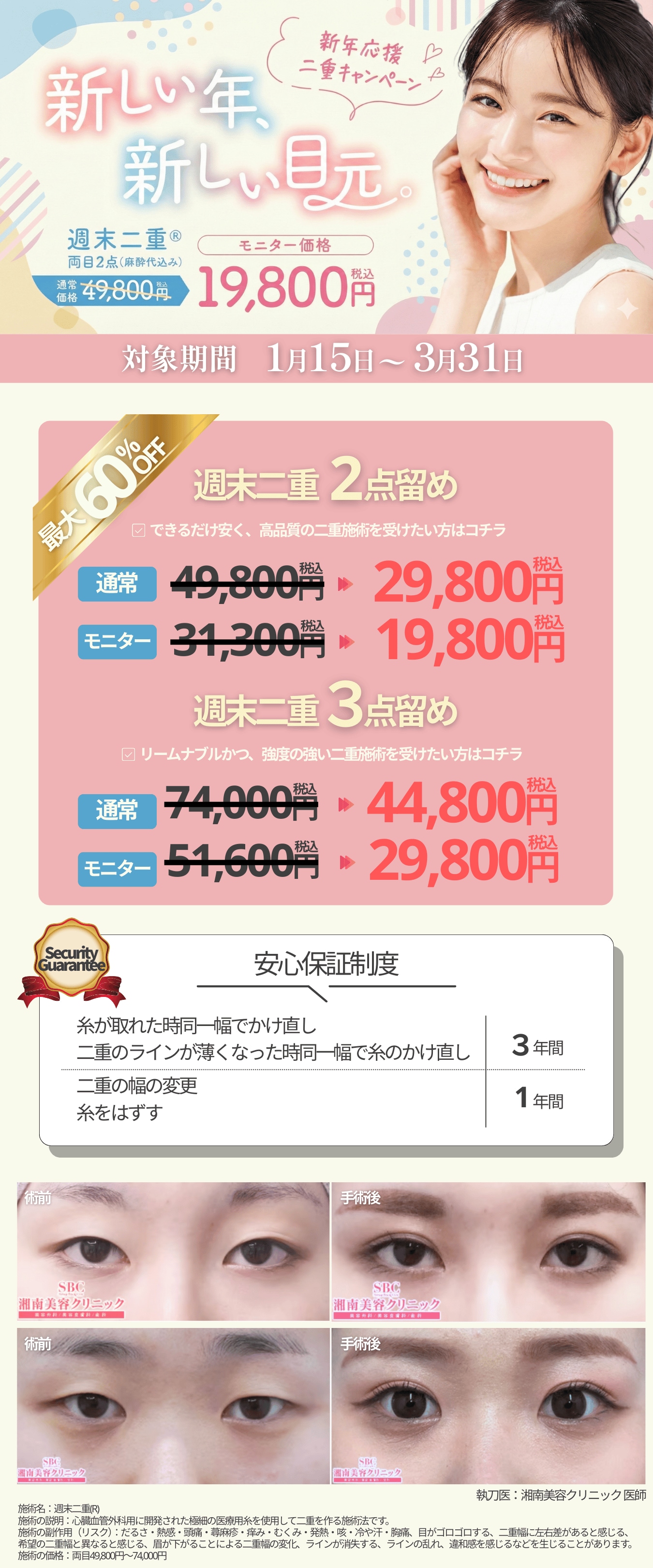 3/31までに手術を受けられる方限定で今だけ週末二重術2点留めが「19,800円」