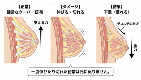 胸(バスト)の形について