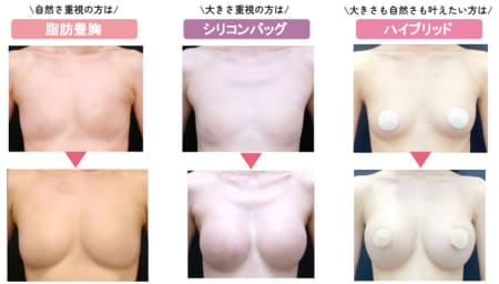 自分に合う施術がわからない方へ