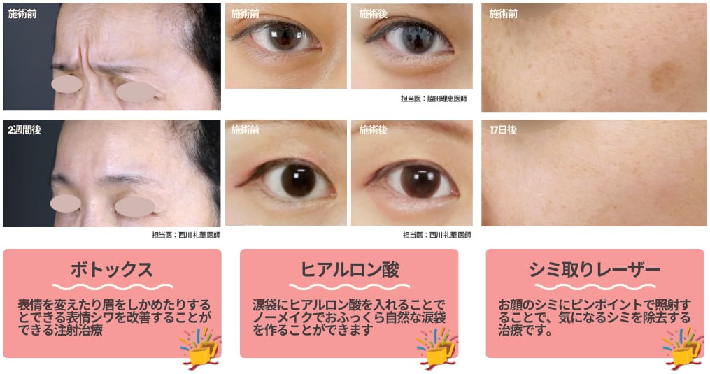 憧れの治療を試してみる