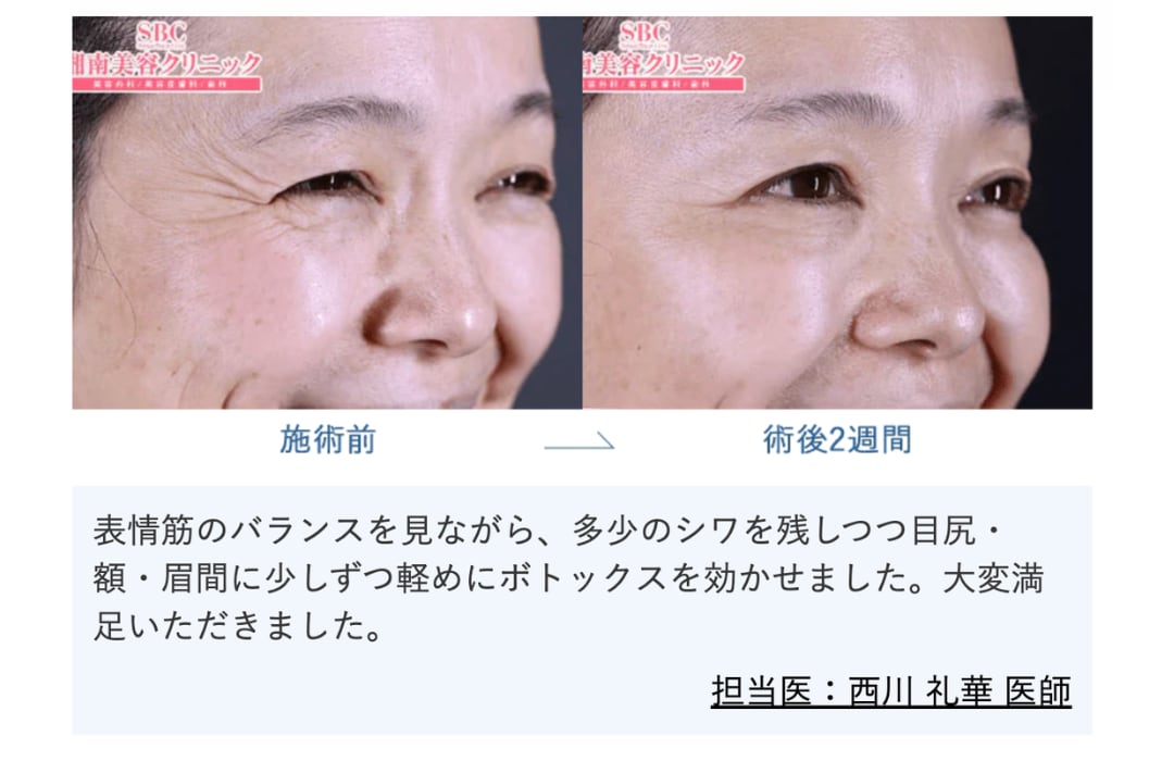 目尻、眉間、額