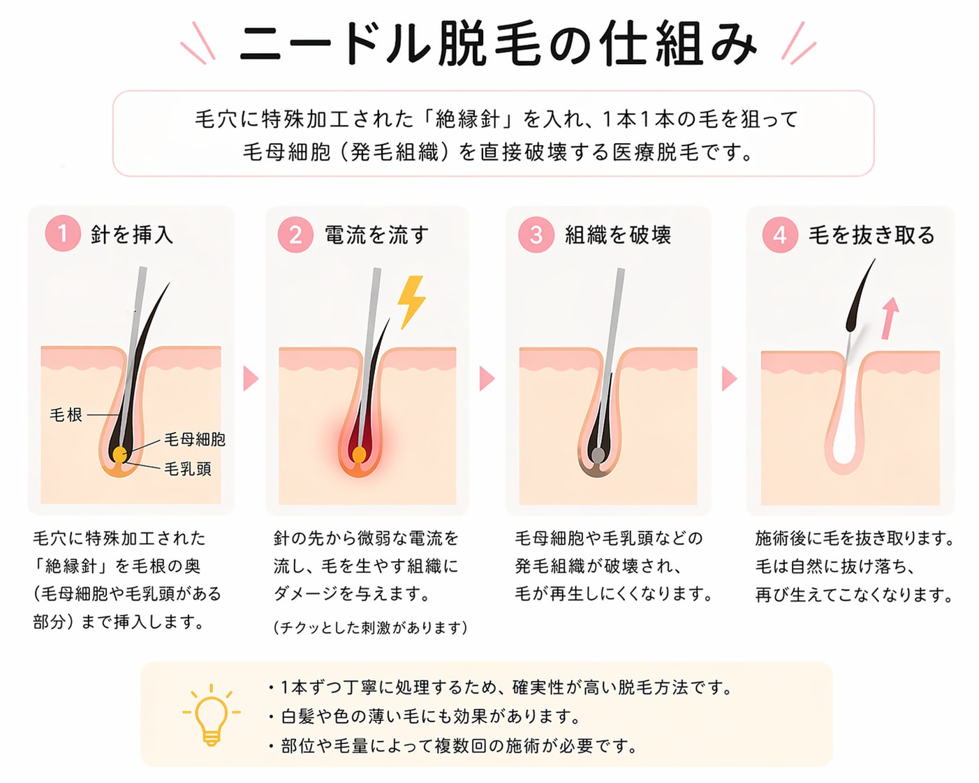 1本ずつ確実に毛根へアプローチする医療脱毛