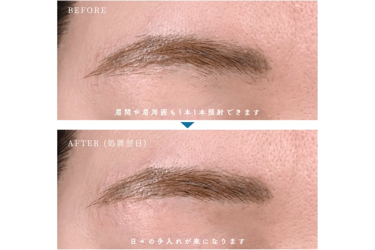 眉毛のデザインや細かい調整に最適