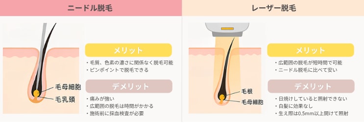 ターゲットとなる毛質と肌質の違い<br />
