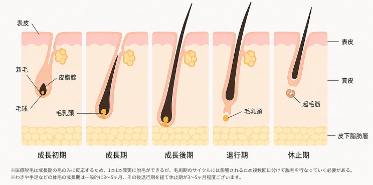 1回の施術でどのくらいの毛がなくなりますか？<br />

