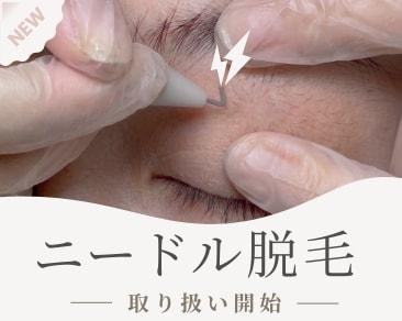 ニードル脱毛ならSBC松山院｜白髪・眉毛・残り毛を解消